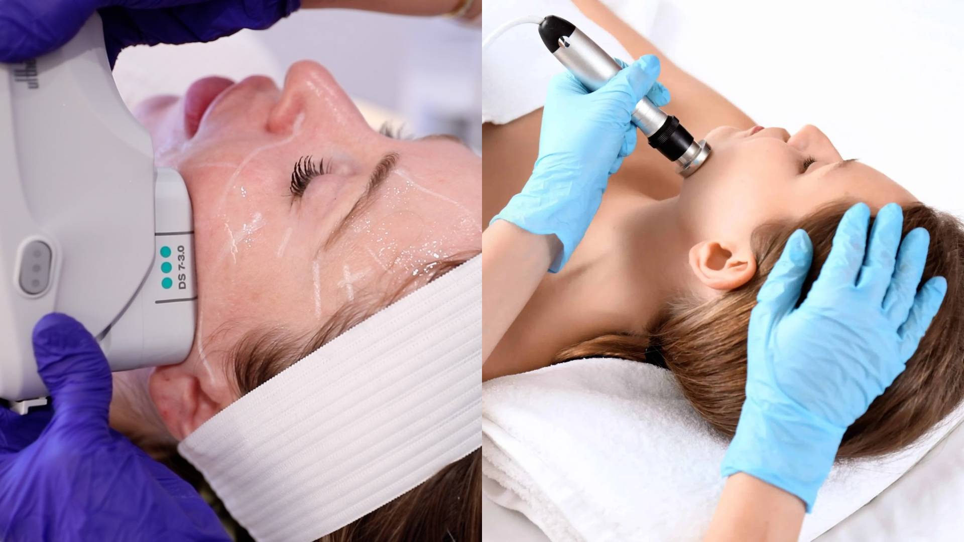 Ultherapy vs. Thermage